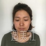 昆山百达丽医院正规吗?做双眼皮有保障吗? width=