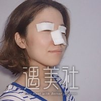 昆山百达丽医院正规吗?做双眼皮有保障吗?