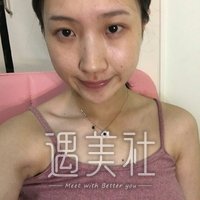 九院的濮哲铭鼻子做的怎么样?有隆鼻案例吗?