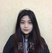 成都华美紫馨陈杨双眼皮术后恢复全过程|名气大医院技术也没的说~ width=
