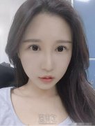 西安路海军医疗美容做双眼皮修复可靠吗?有案例吗? width=