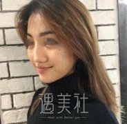 谢卫国做鼻子怎么样|谢卫国隆鼻案例分享~ width=