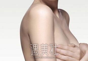假体隆胸