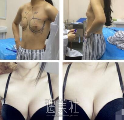 广州,军美,王世虎