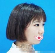 上海九院戴传昌鼻案例：有名大咖就是不一样！ width=