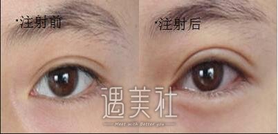 上海,九院,卧蚕
