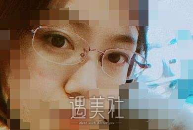 九院,濮哲铭,去眼袋