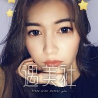 王琪影做的双眼皮案例果怎么样?我想要尝试一下~