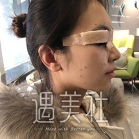 王琪影做的双眼皮案例果怎么样?我想要尝试一下~
