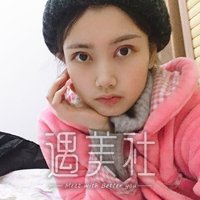 郑大二附院刘月丽双眼皮案例展示，果真自然~