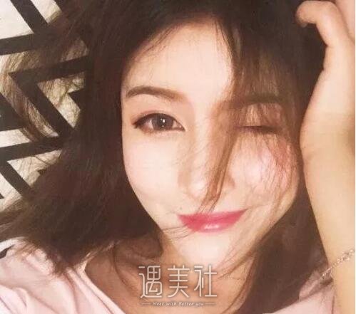 武汉亚太程晓林做鼻子技术怎么样?案例及果图一览~