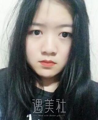 毕洪森面部吸脂技术有保障吗?相关案例展示~