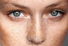 兰州陆军总院祛斑价格是多少？收费贵吗？ width=
