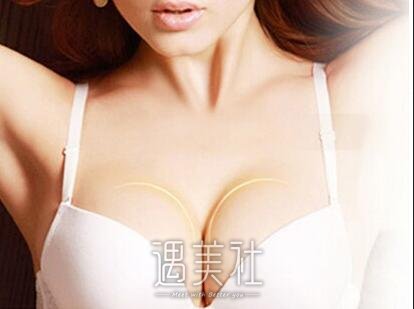 假体隆胸