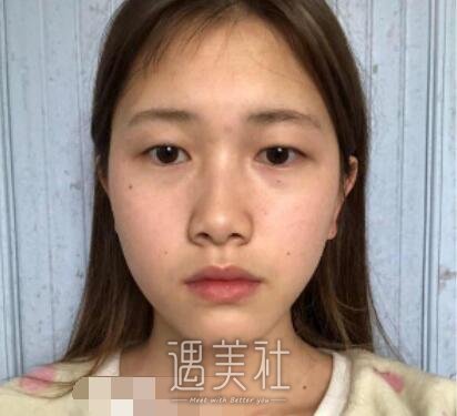 九院,苏薇洁