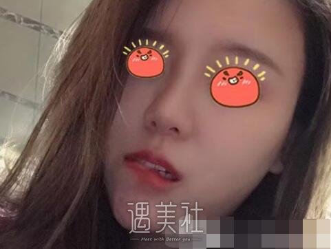 上海,pro,鼻部手术