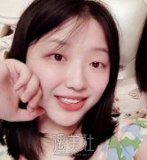 西安孙峰双眼皮案例分享|术后实时记录~ width=