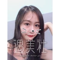 深圳恩吉娜双眼皮果怎么样?案例及果图一览~