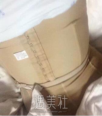 杭州静港程卫民吸脂果好不好?看看我的真实案例吧!