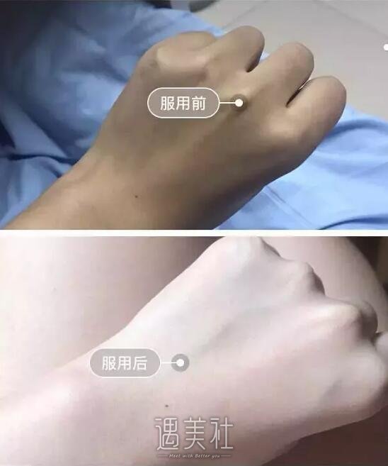 上海九院整形医院能做美白项目吗?官网价格贵吗?