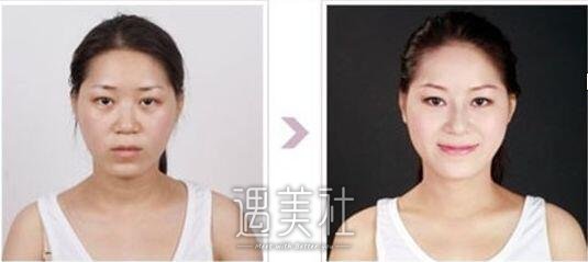 上海九院整形医院能做美白项目吗?官网价格贵吗?
