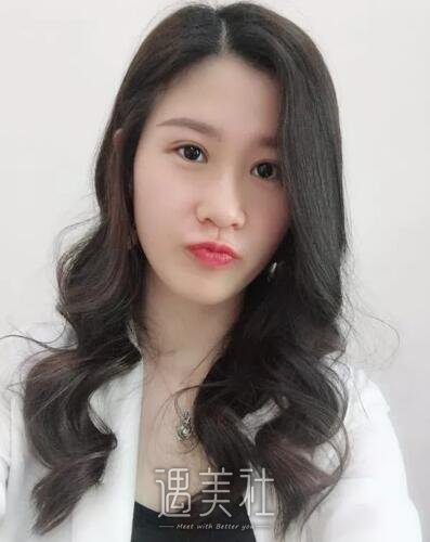 王琪影做的双眼皮果如何?有没有真实的案例分享?