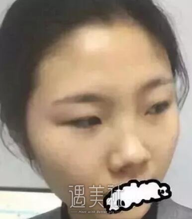 亚太,程晓林