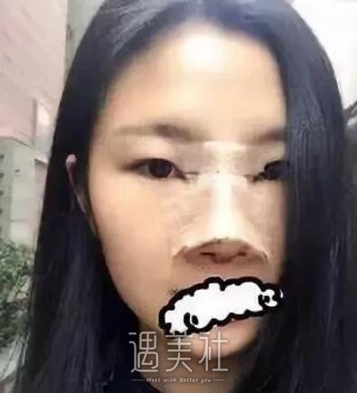 亚太,程晓林