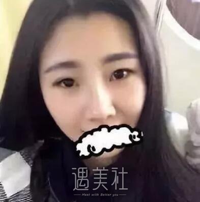 亚太,程晓林