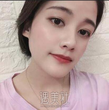 沈阳,陆军总院,光子嫩肤