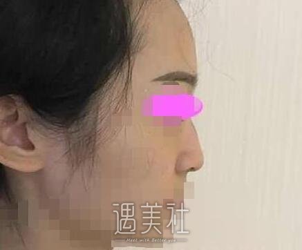 上海,美立方,任天平,隆鼻