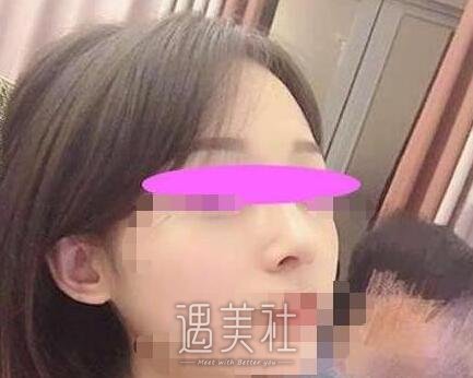 上海,美立方,任天平,隆鼻