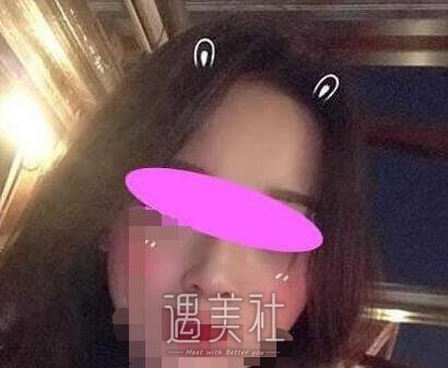 上海,美立方,任天平,隆鼻