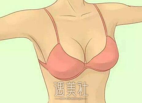 鲁峰,自体脂肪移植丰胸