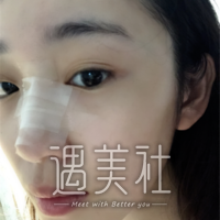 连云港大明整形医院隆鼻技术怎么样?做调节能放心吗?