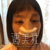 上海翔茂整形医院有隆鼻案例吗?表妹想去做整形!