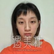 上海翔茂整形医院有隆鼻案例吗?表妹想去做整形! width=