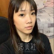 上海薇琳整形医院价目表|顾陆健耳软骨隆鼻真实体验案例分享 width=