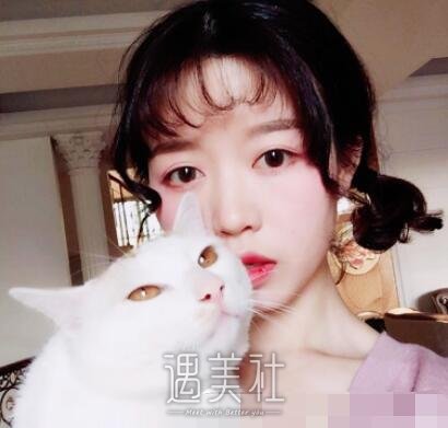 柳民熙,隆鼻
