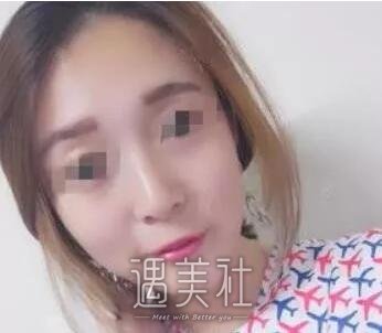 哈尔滨211医院激光祛斑实力如何?真实案例一览~