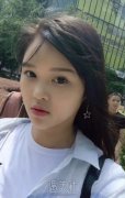 杭州117医院整形科价格表：赵启明鼻部手术术前术后对比图~ width=