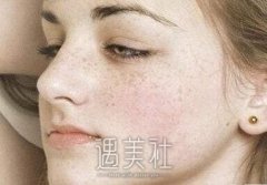 上海九院祛斑价目表2020震撼一览~ width=