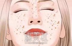 西安唐都医院激光祛斑多少钱？ width=