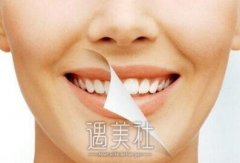 山东齐鲁医院洗牙多少钱？ width=