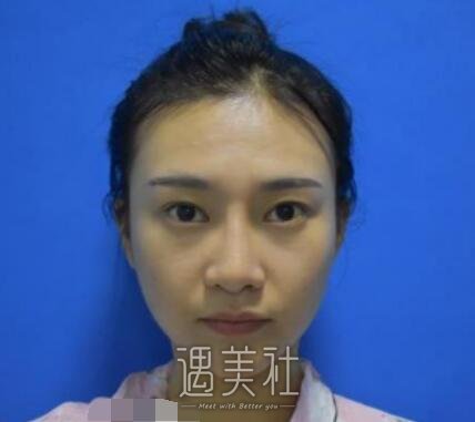合肥,褚燕军