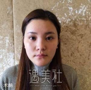 上海,百达丽,韩嘉毅,隆鼻