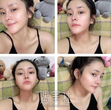 上海,百达丽,韩嘉毅,隆鼻