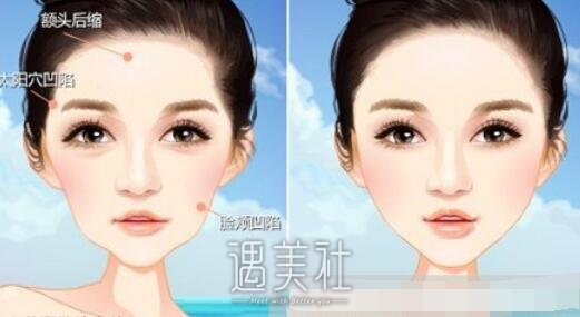 活细胞填充