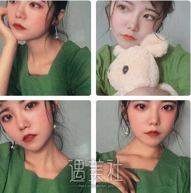 成都,自体脂肪填充