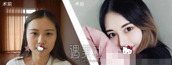 成都,肖凌